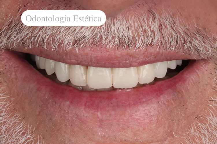 serviço-odontologia-estética